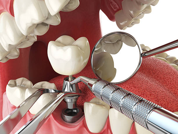 Best Emergency Denture Repair in India Hook, SC